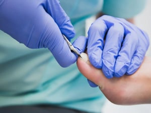 Ingrown Toenail