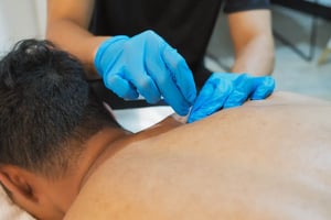 Physio - Dry Needling - Neck Pain 3