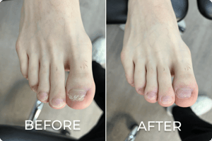 potential-treatment-outcomes-7